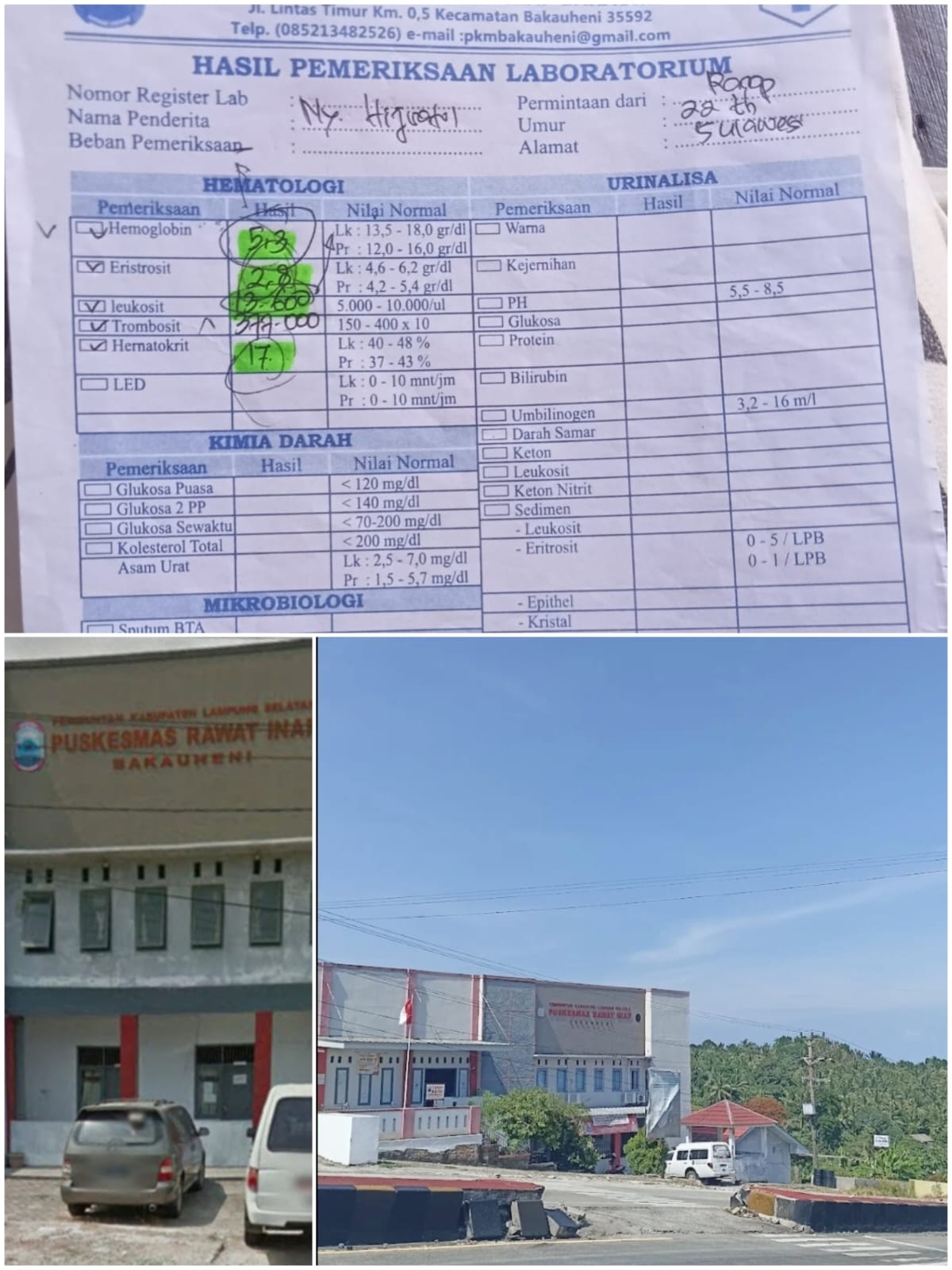 Bidan Berinisial A Dipuskes Bakauheni Kabupaten Lampung Selatan Diduga Melakukan Malpraktik